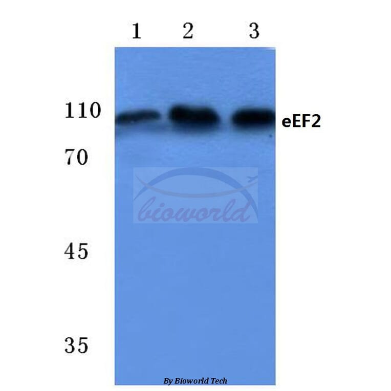 Anti-EEF2 (A50) Antibody from Bioworld Technology (BS1099) - Antibodies.com