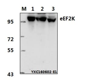 Anti-eEF2K (P360) Antibody from Bioworld Technology (BS1100) - Antibodies.com