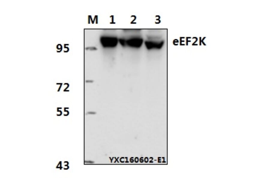 Anti-eEF2K (P360) Antibody from Bioworld Technology (BS1100) - Antibodies.com