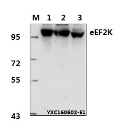 Anti-eEF2K (P360) Antibody from Bioworld Technology (BS1100) - Antibodies.com