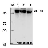 Anti-eEF2K (P360) Antibody from Bioworld Technology (BS1100) - Antibodies.com