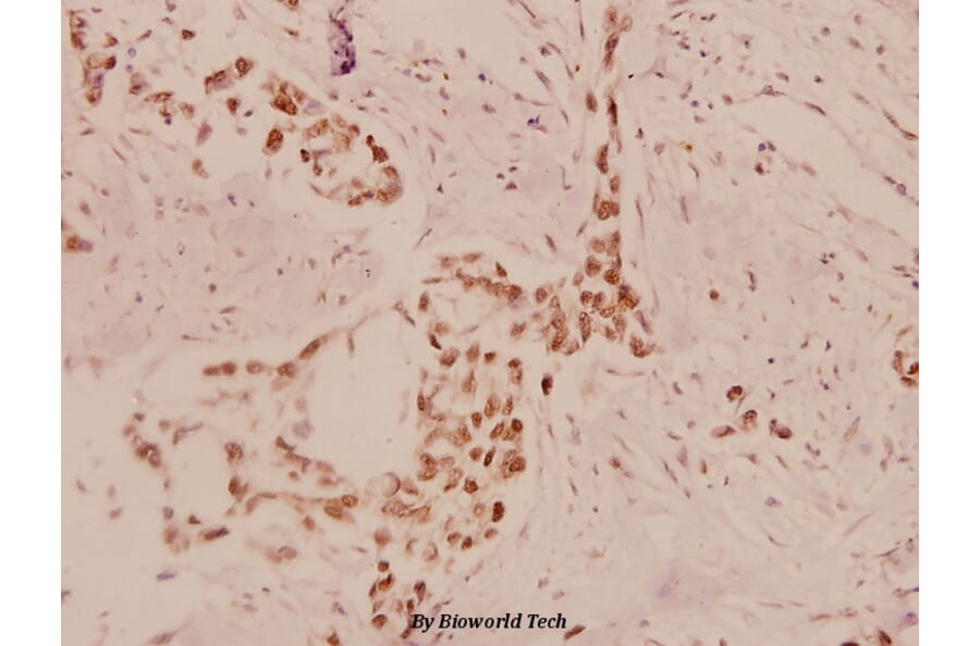 Anti-eEF2K (P360) Antibody from Bioworld Technology (BS1100) - Antibodies.com