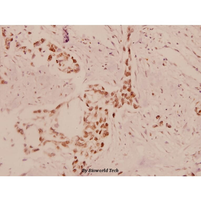 Anti-eEF2K (P360) Antibody from Bioworld Technology (BS1100) - Antibodies.com