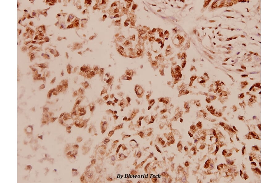 Anti-EGFR (F1086) Antibody from Bioworld Technology (BS1102) - Antibodies.com