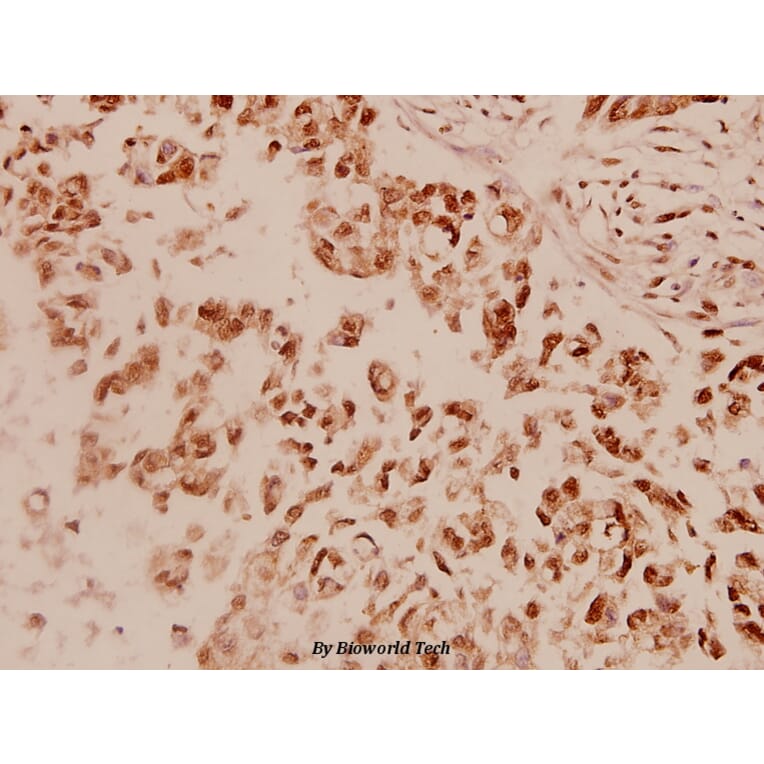 Anti-EGFR (F1086) Antibody from Bioworld Technology (BS1102) - Antibodies.com