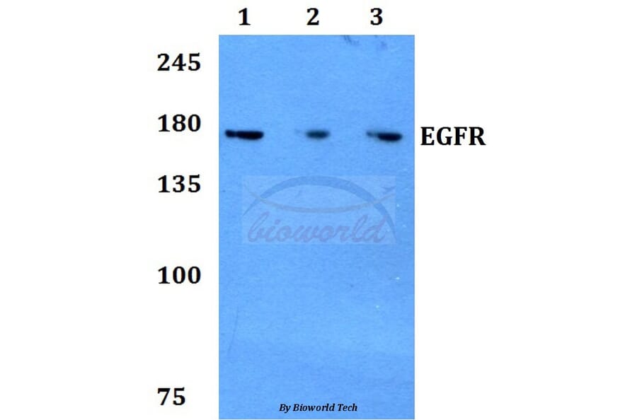 Anti-EGFR (H672) Antibody from Bioworld Technology (BS1103) - Antibodies.com