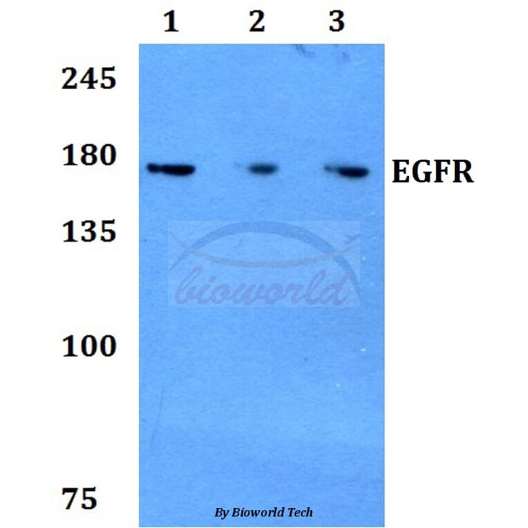 Anti-EGFR (H672) Antibody from Bioworld Technology (BS1103) - Antibodies.com