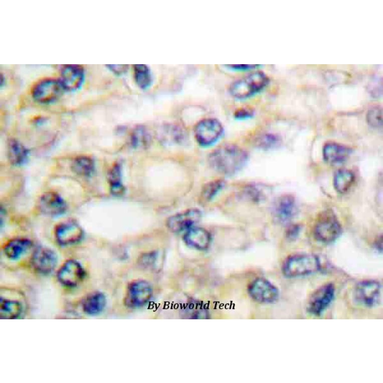 Anti-EGFR (H672) Antibody from Bioworld Technology (BS1103) - Antibodies.com