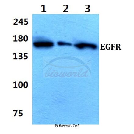 Anti-EGFR (E687) Antibody from Bioworld Technology (BS1104) - Antibodies.com