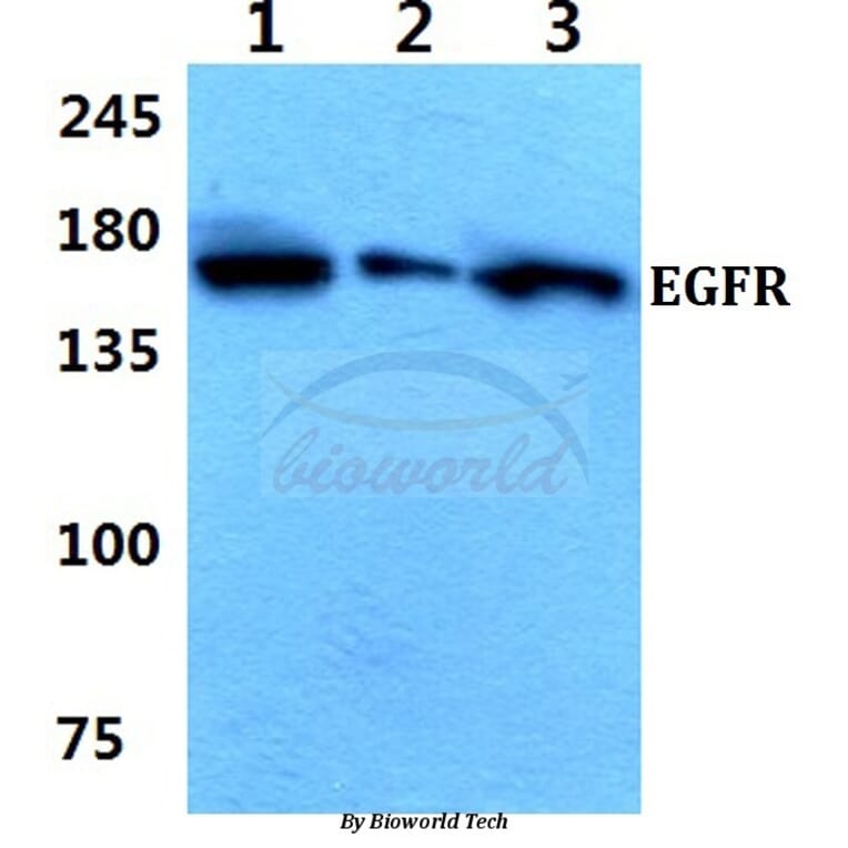 Anti-EGFR (E687) Antibody from Bioworld Technology (BS1104) - Antibodies.com