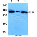 Anti-EGFR (E687) Antibody from Bioworld Technology (BS1104) - Antibodies.com