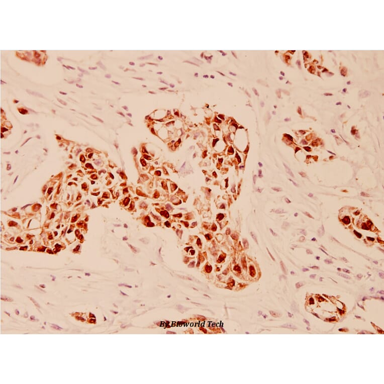 Anti-EGFR (E687) Antibody from Bioworld Technology (BS1104) - Antibodies.com
