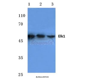 Anti-Elk1 (H377) Antibody from Bioworld Technology (BS1105) - Antibodies.com