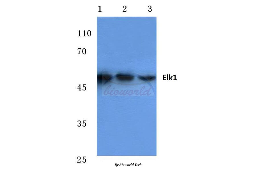 Anti-Elk1 (H377) Antibody from Bioworld Technology (BS1105) - Antibodies.com