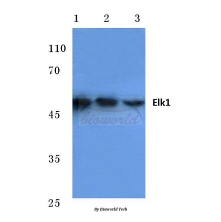 Anti-Elk1 (H377) Antibody from Bioworld Technology (BS1105) - Antibodies.com