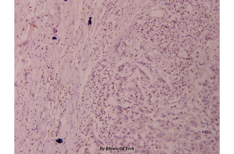 Anti-Elk1 (H377) Antibody from Bioworld Technology (BS1105) - Antibodies.com