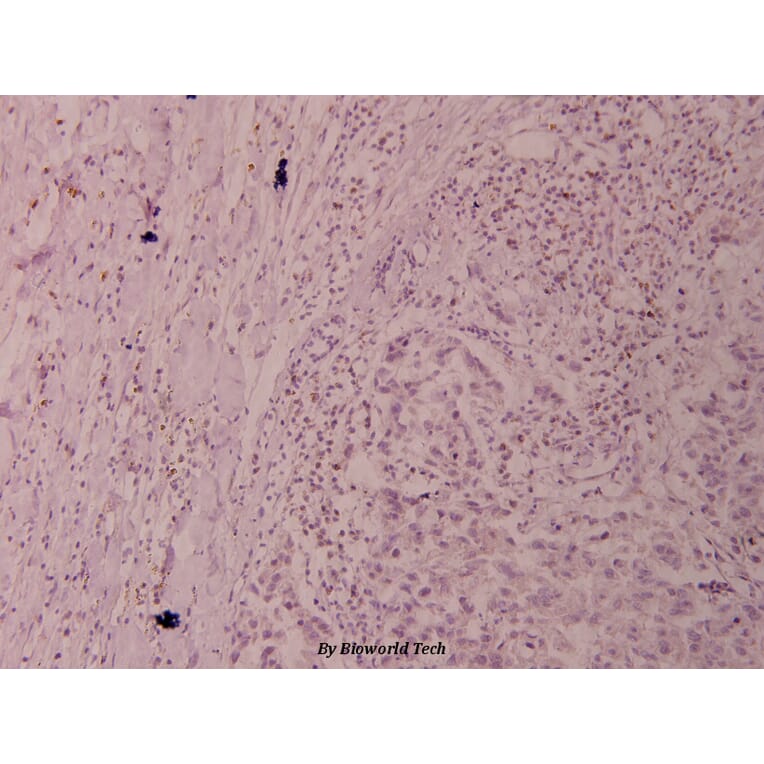 Anti-Elk1 (H377) Antibody from Bioworld Technology (BS1105) - Antibodies.com