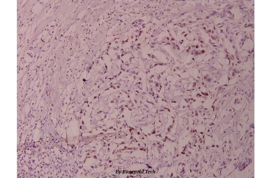 Anti-Elk1 (S383) Antibody from Bioworld Technology (BS1106) - Antibodies.com