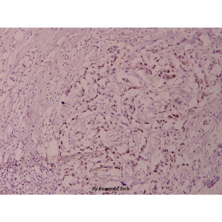 Anti-Elk1 (S383) Antibody from Bioworld Technology (BS1106) - Antibodies.com