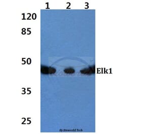 Anti-Elk1 (S411) Antibody from Bioworld Technology (BS1107) - Antibodies.com