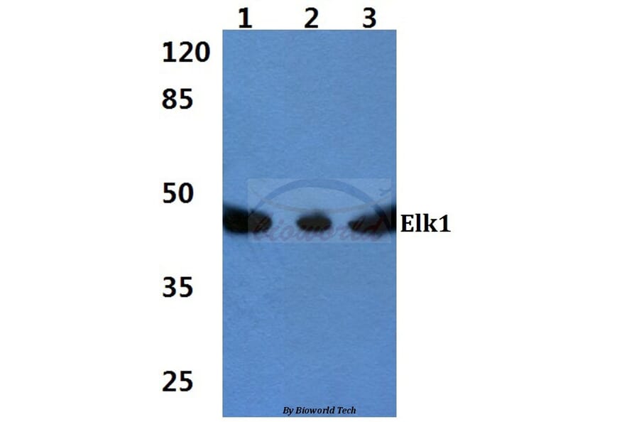 Anti-Elk1 (S411) Antibody from Bioworld Technology (BS1107) - Antibodies.com