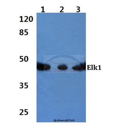Anti-Elk1 (S411) Antibody from Bioworld Technology (BS1107) - Antibodies.com