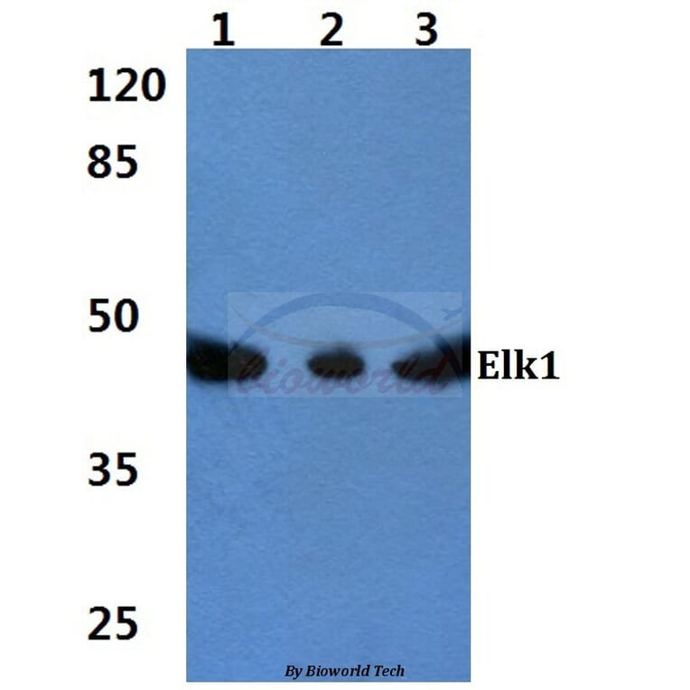 Anti-Elk1 (S411) Antibody from Bioworld Technology (BS1107) - Antibodies.com
