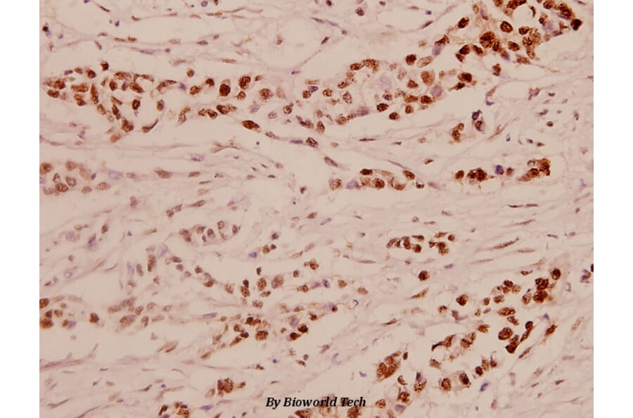 Anti-Elk1 (S411) Antibody from Bioworld Technology (BS1107) - Antibodies.com