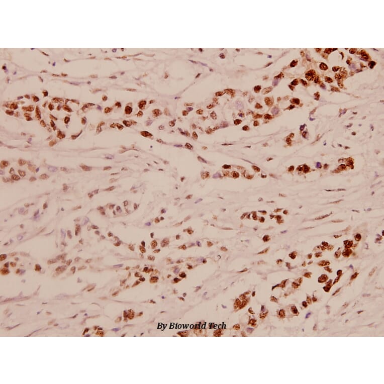 Anti-Elk1 (S411) Antibody from Bioworld Technology (BS1107) - Antibodies.com