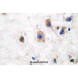 Anti-Ephrin-B3 (W251) Antibody from Bioworld Technology (BS1110) - Antibodies.com