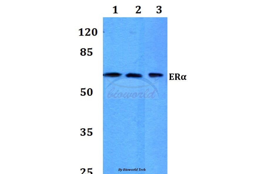Anti-ERα (P98) Antibody from Bioworld Technology (BS1113) - Antibodies.com