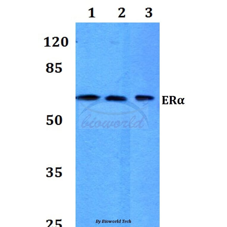 Anti-ERα (P98) Antibody from Bioworld Technology (BS1113) - Antibodies.com