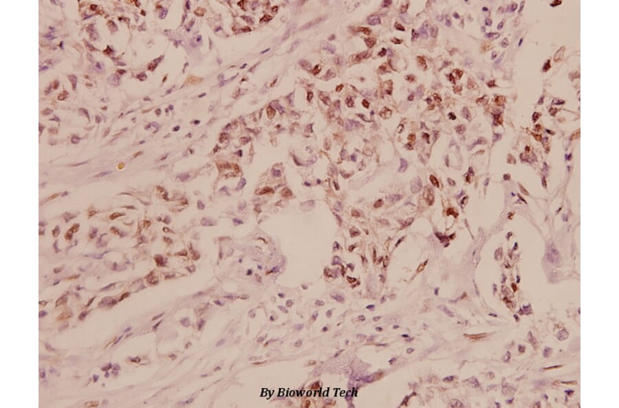 Anti-ERα (P98) Antibody from Bioworld Technology (BS1113) - Antibodies.com