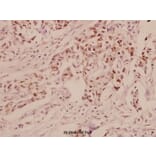 Anti-ERα (P98) Antibody from Bioworld Technology (BS1113) - Antibodies.com