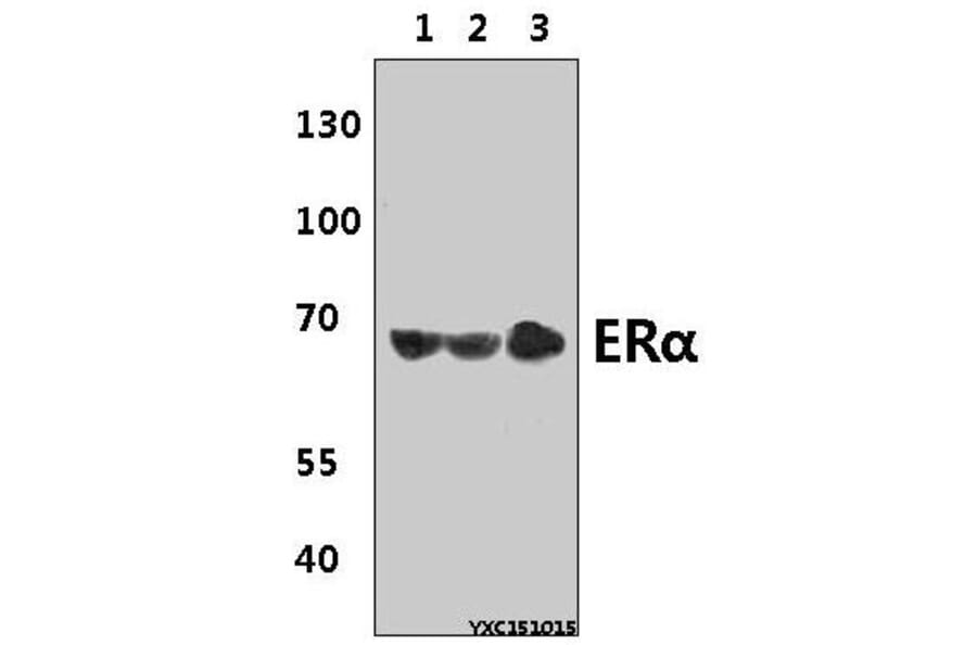 Anti-ERα (L100) Antibody from Bioworld Technology (BS1114) - Antibodies.com