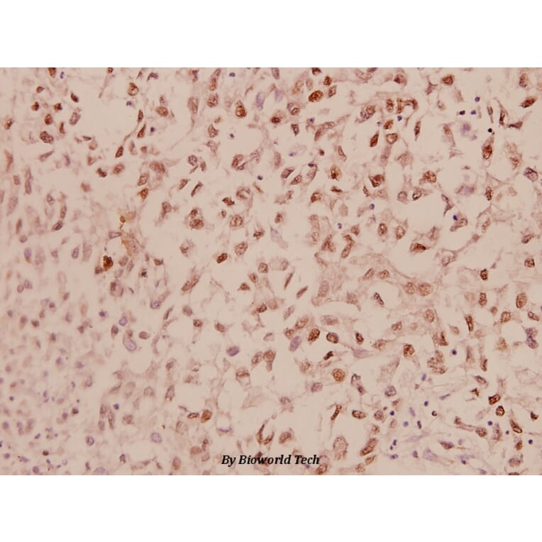 Anti-ERα (L100) Antibody from Bioworld Technology (BS1114) - Antibodies.com