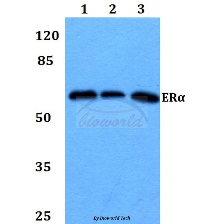 Anti-ERα (H112) Antibody from Bioworld Technology (BS1115) - Antibodies.com