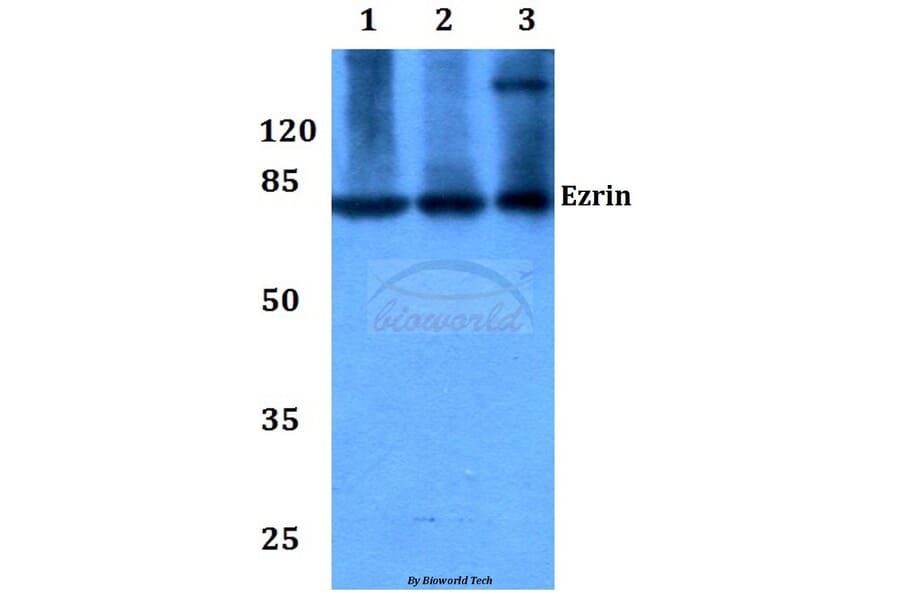 Anti-Ezrin (S539) Antibody from Bioworld Technology (BS1117) - Antibodies.com