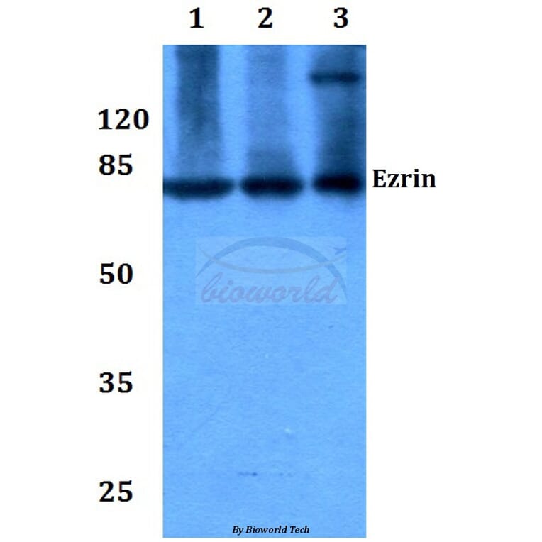 Anti-Ezrin (S539) Antibody from Bioworld Technology (BS1117) - Antibodies.com