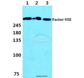 Anti-F8 (S2194) Antibody from Bioworld Technology (BS1119) - Antibodies.com