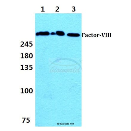 Anti-F8 (S2194) Antibody from Bioworld Technology (BS1119) - Antibodies.com