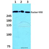 Anti-F8 (S2194) Antibody from Bioworld Technology (BS1119) - Antibodies.com