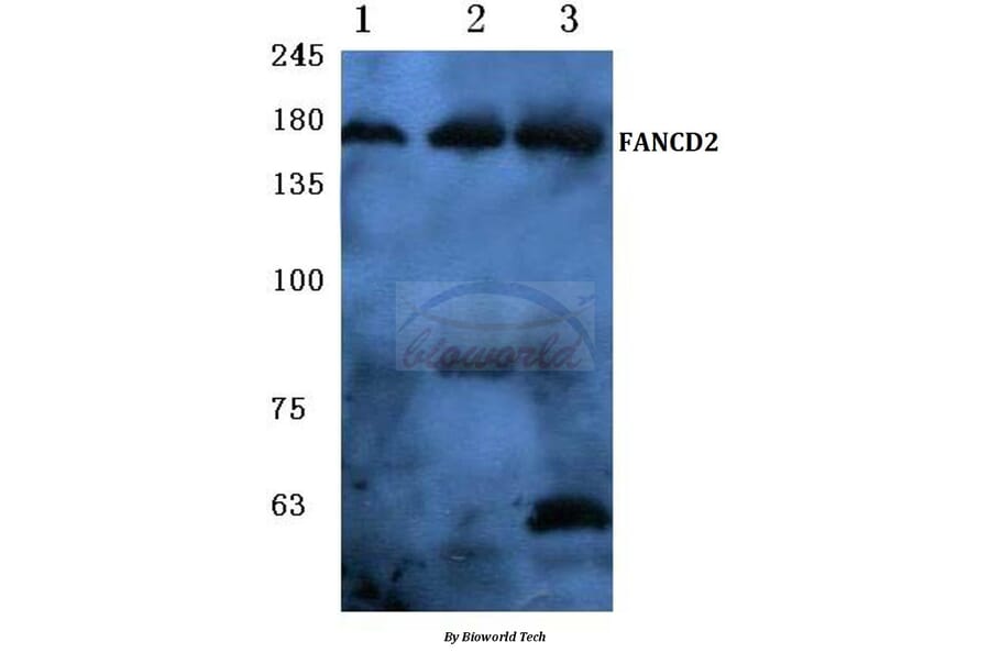 Anti-FANCD2 (P216) Antibody from Bioworld Technology (BS1120) - Antibodies.com
