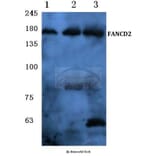 Anti-FANCD2 (P216) Antibody from Bioworld Technology (BS1120) - Antibodies.com