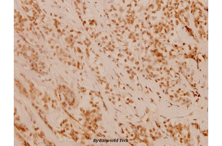 Anti-FANCD2 (P216) Antibody from Bioworld Technology (BS1120) - Antibodies.com