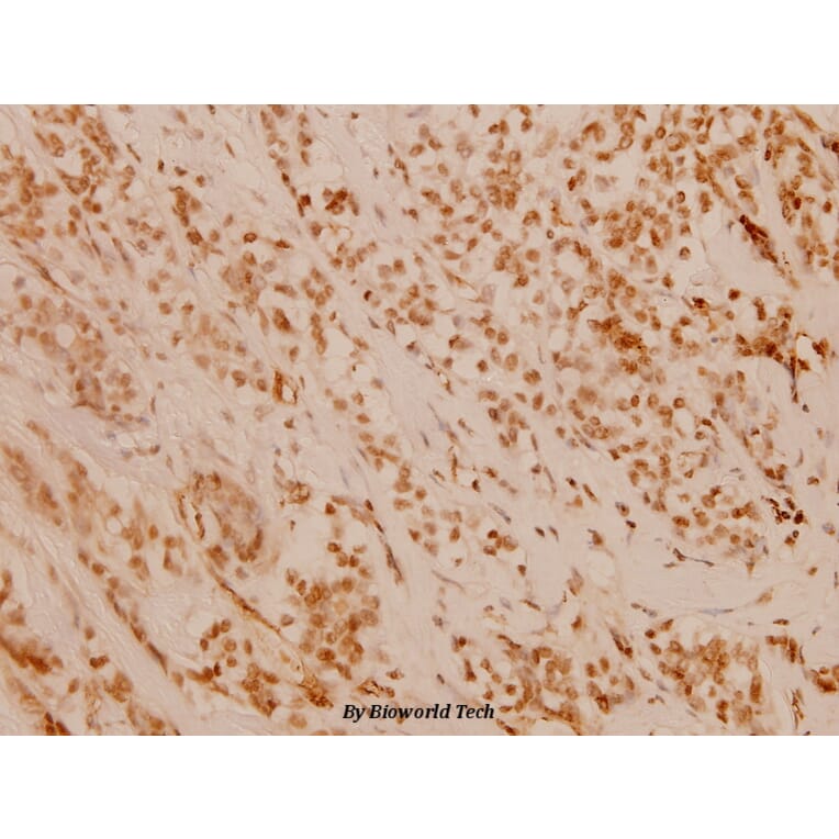 Anti-FANCD2 (P216) Antibody from Bioworld Technology (BS1120) - Antibodies.com