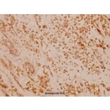 Anti-FANCD2 (P216) Antibody from Bioworld Technology (BS1120) - Antibodies.com