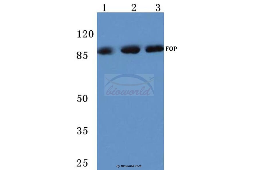 Anti-FGFR1 OP (N371) Antibody from Bioworld Technology (BS1123) - Antibodies.com