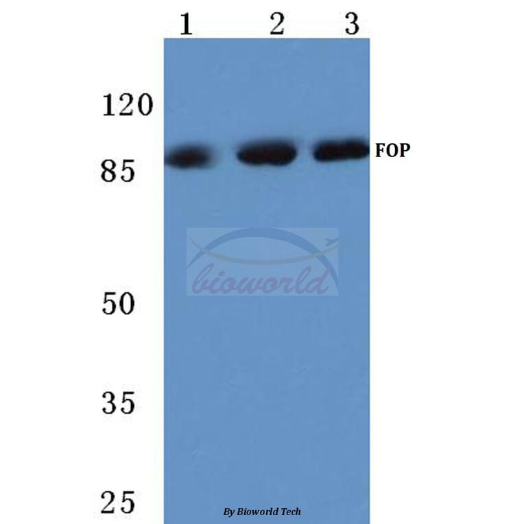 Anti-FGFR1 OP (N371) Antibody from Bioworld Technology (BS1123) - Antibodies.com