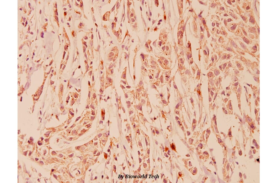 Anti-FGFR1 OP (N371) Antibody from Bioworld Technology (BS1123) - Antibodies.com
